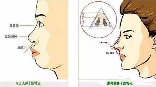 什么是鼻梁增高针?有危害吗?