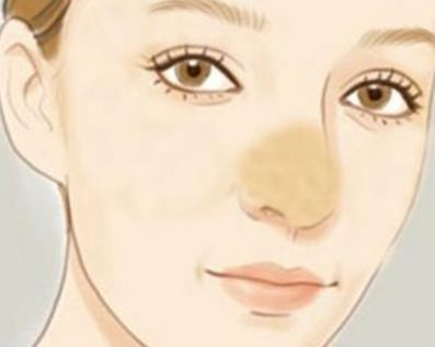 耳软骨隆鼻手术后的注意事项?耳软骨隆鼻的缺点是什么?