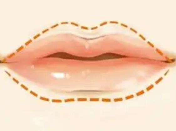 做嘟嘟唇可以冰敷吗，丰唇的效果可以维持多久？