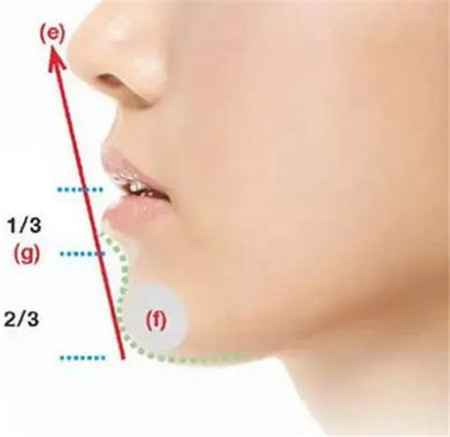 垫下巴的类型有哪些?垫下巴后如何保养