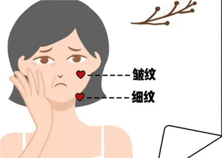 去除额头皱纹的方法有哪些