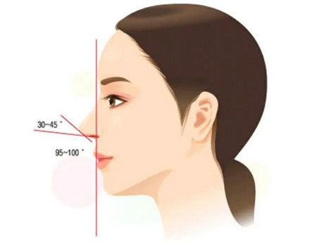 驼峰鼻矫正方法有哪些?