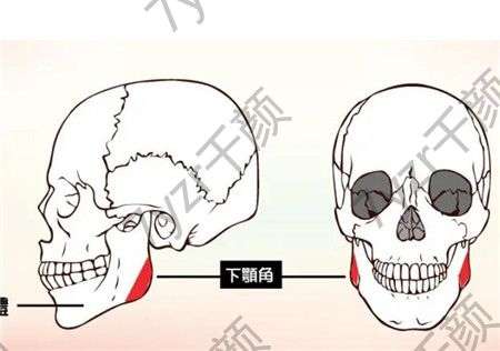 截骨术有什么优点和缺点