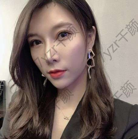 做隆鼻手术的医院是我比较熟悉的医院