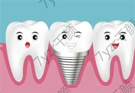 维护好固定假牙能够避免固定假牙松动