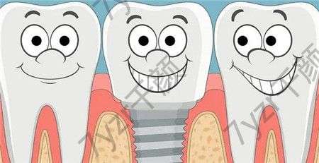 种植牙是一种流行的治疗方法