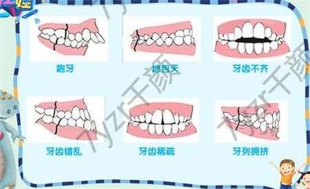 整牙是指通过正畸治疗，对口腔的牙齿进行纠正