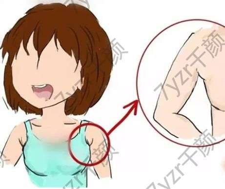 副乳切除术会影响身体吗，副乳切除复杂吗
