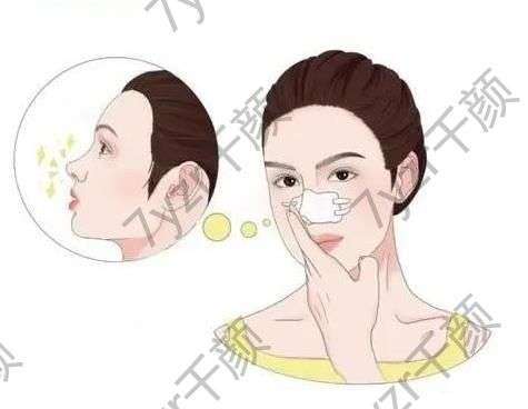 垫鼻梁适合哪些人群?