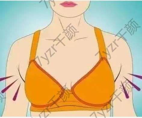 副乳切除有哪些风险，有哪些并发症