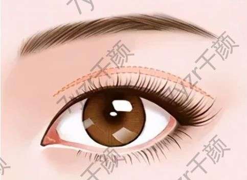 北京靳小雷双眼皮修复效果如何？八大处坐诊信息及价格、案例展示