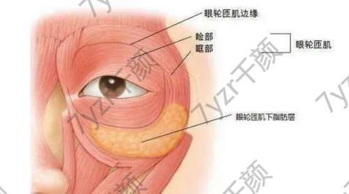 眼部抽脂手术大概花多少钱？做眼部抽脂手术医院了解一下